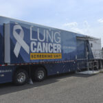 lung cancer screening truck exterior